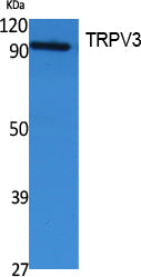 TRPV3 Rabbit Polyclonal Antibody