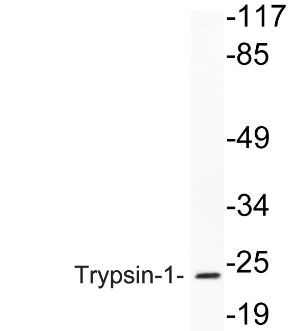 Trypsin-1 Rabbit Polyclonal Antibody