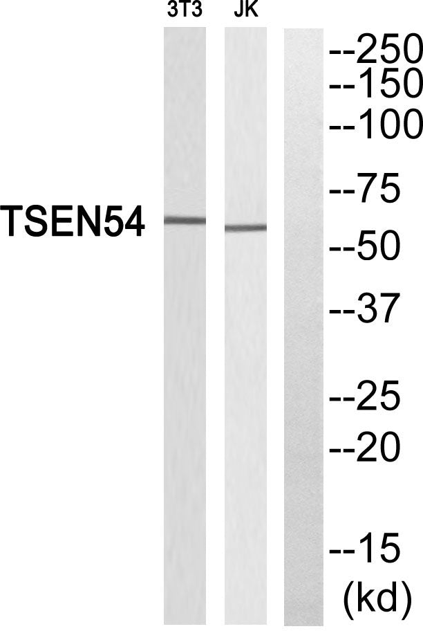 TSEN54 Rabbit Polyclonal Antibody