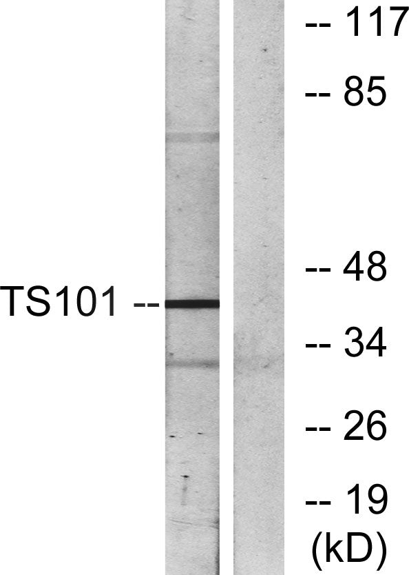 Tsg 101 Rabbit Polyclonal Antibody