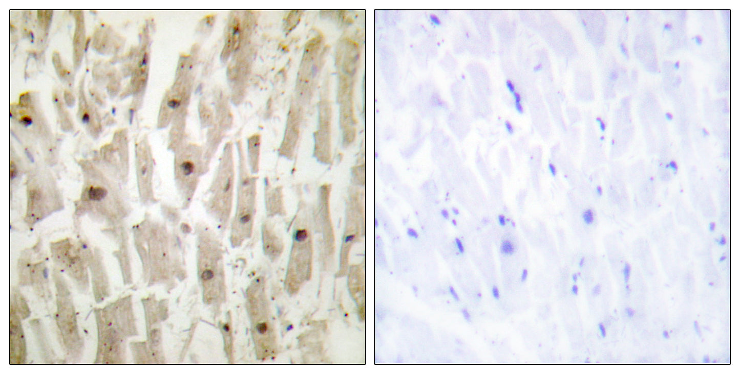 TSHZ1 Rabbit Polyclonal Antibody