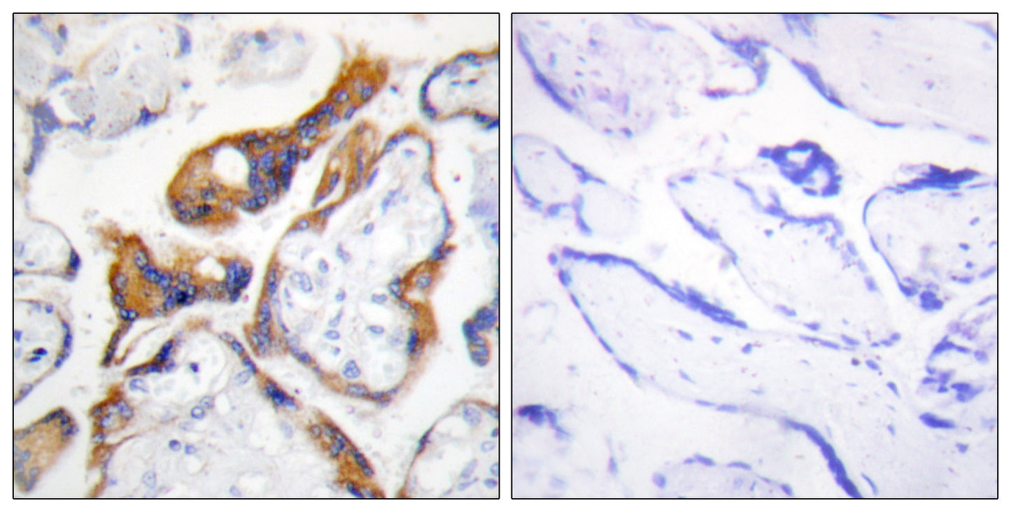 TSSC3 Rabbit Polyclonal Antibody