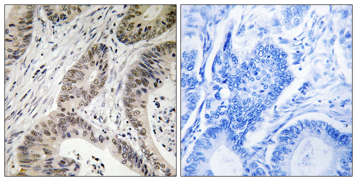 TUTase Rabbit Polyclonal Antibody