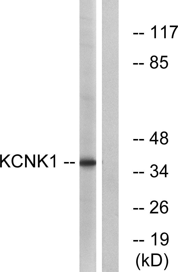 TWIK-1 Rabbit Polyclonal Antibody