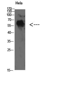 TyrRS Rabbit Polyclonal Antibody