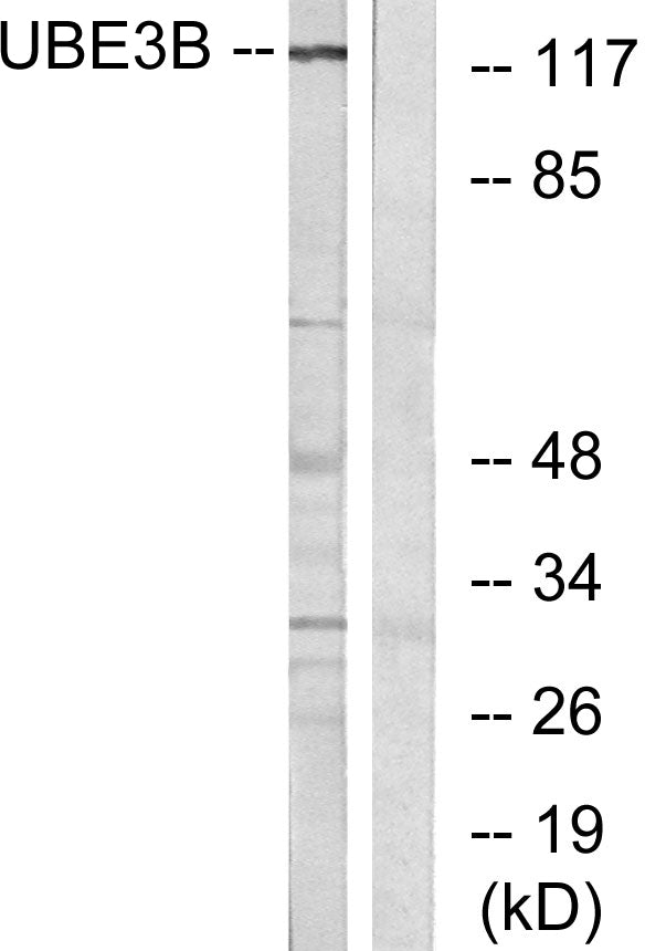 UBE3B Rabbit Polyclonal Antibody
