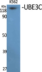UBE3C Rabbit Polyclonal Antibody