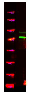 UBP49 Rabbit Polyclonal Antibody