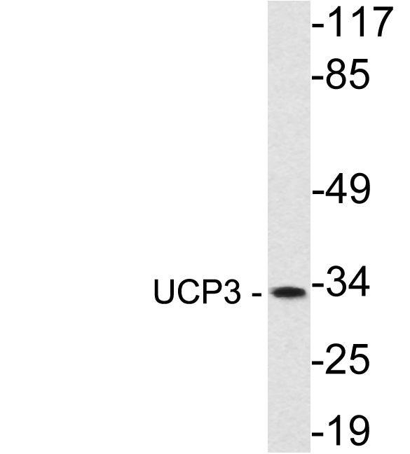 UCP3 Rabbit Polyclonal Antibody