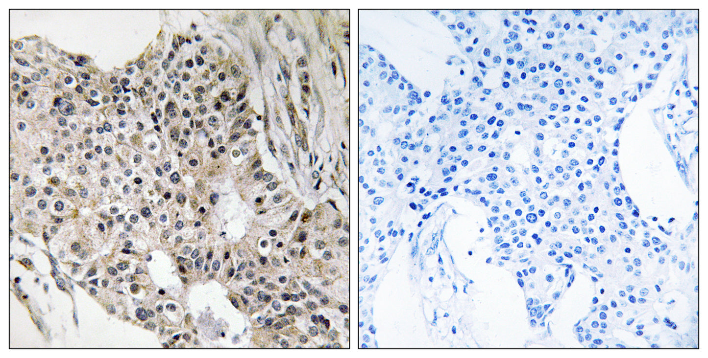 UEV3 Rabbit Polyclonal Antibody