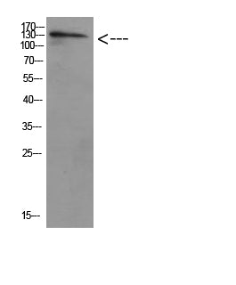 ULK2 Rabbit Polyclonal Antibody