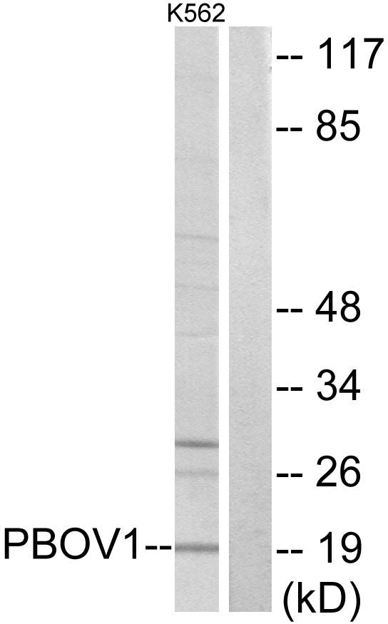 UROC28 Rabbit Polyclonal Antibody