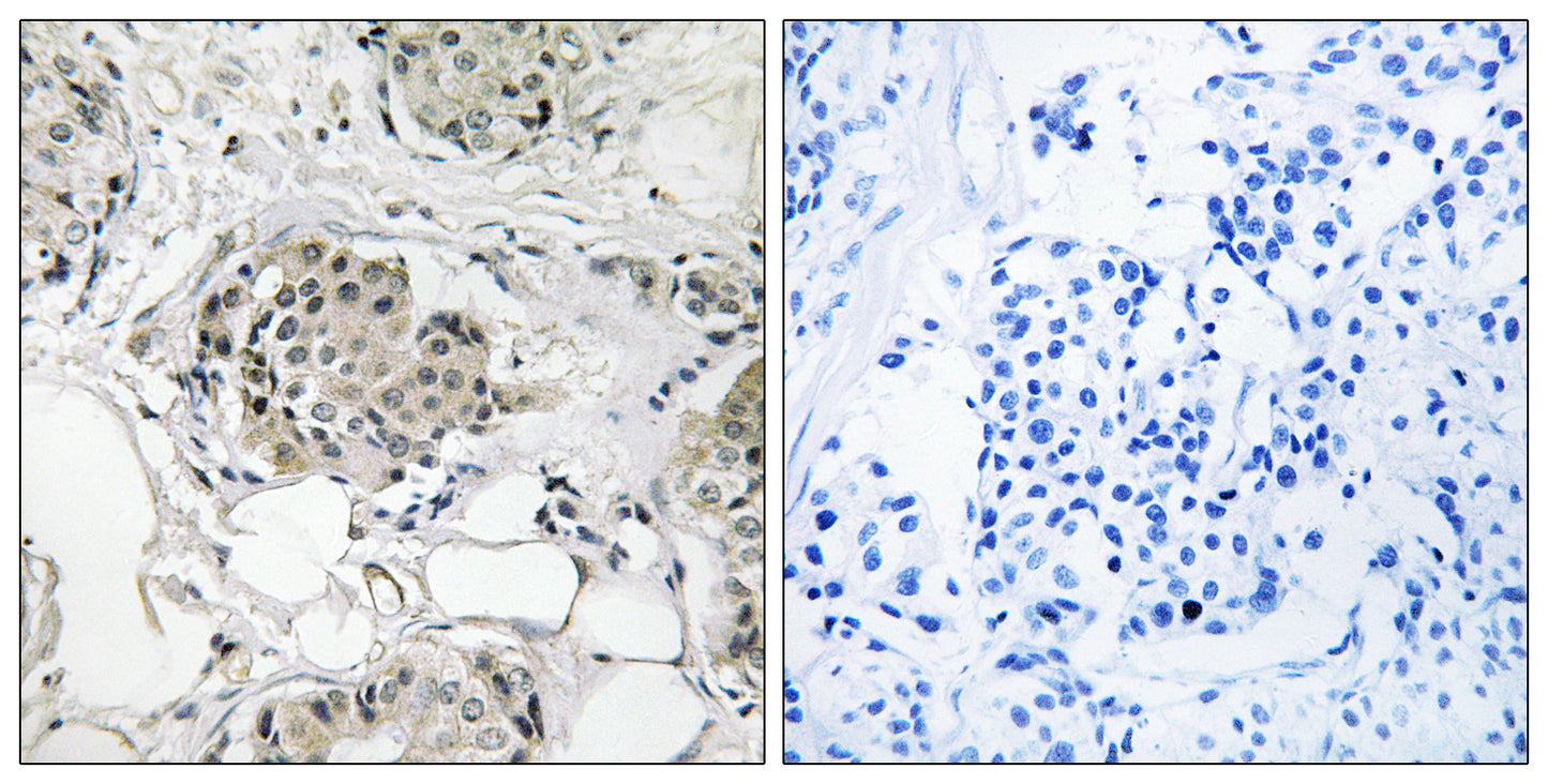USP13 Rabbit Polyclonal Antibody