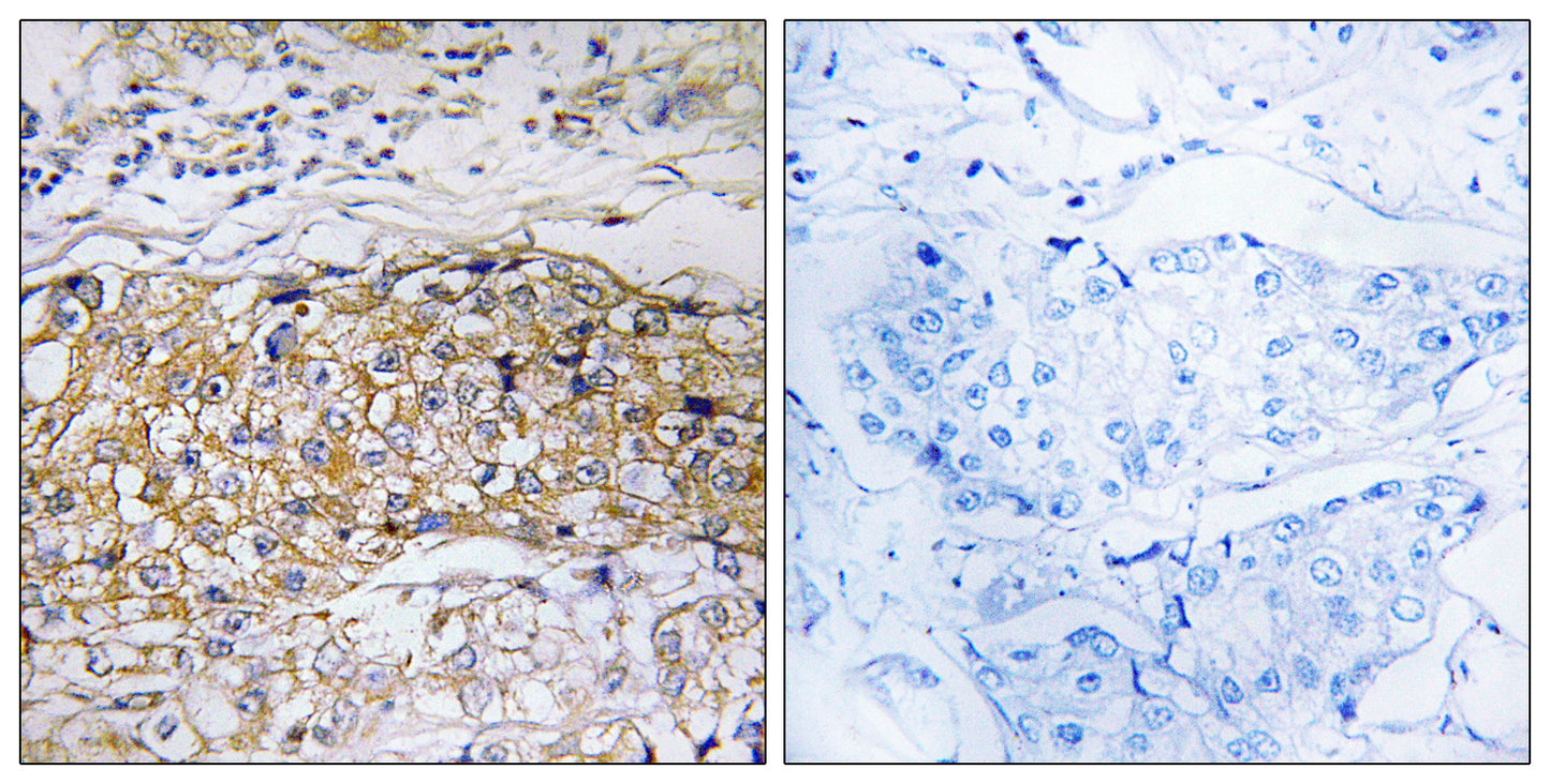 USP24 Rabbit Polyclonal Antibody