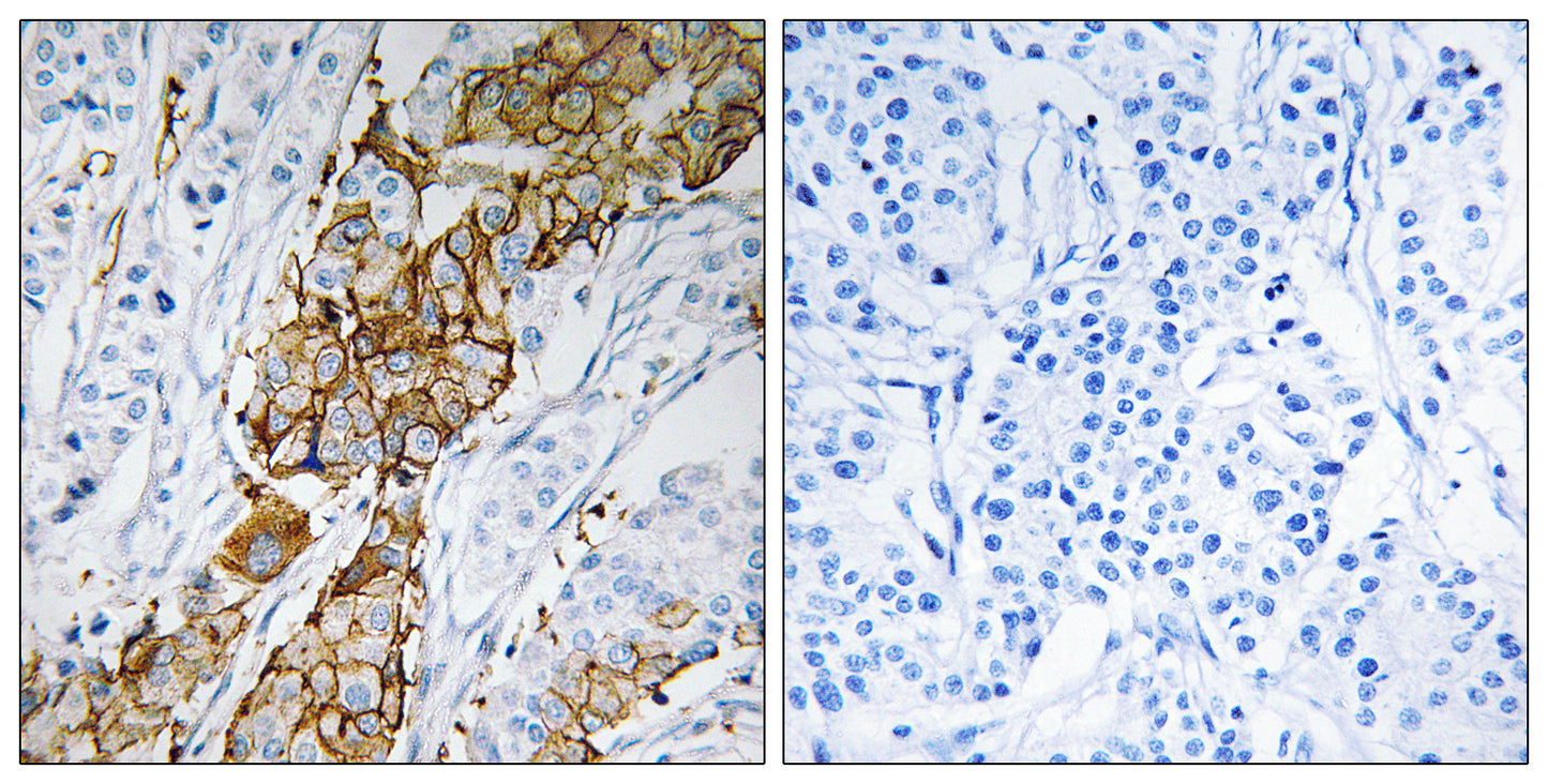 USP32 Rabbit Polyclonal Antibody