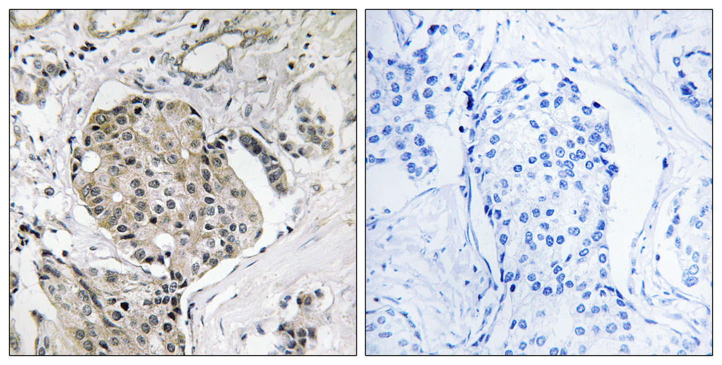 USP40 Rabbit Polyclonal Antibody