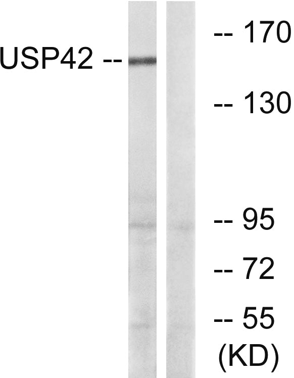 USP42 Rabbit Polyclonal Antibody