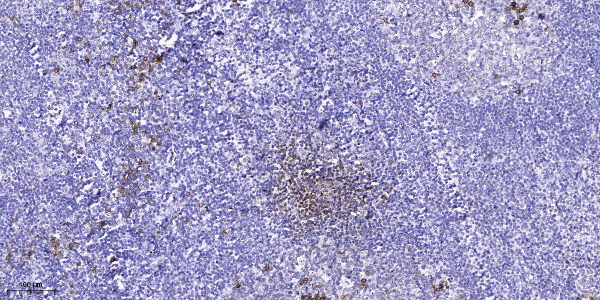 UTRO Rabbit Polyclonal Antibody