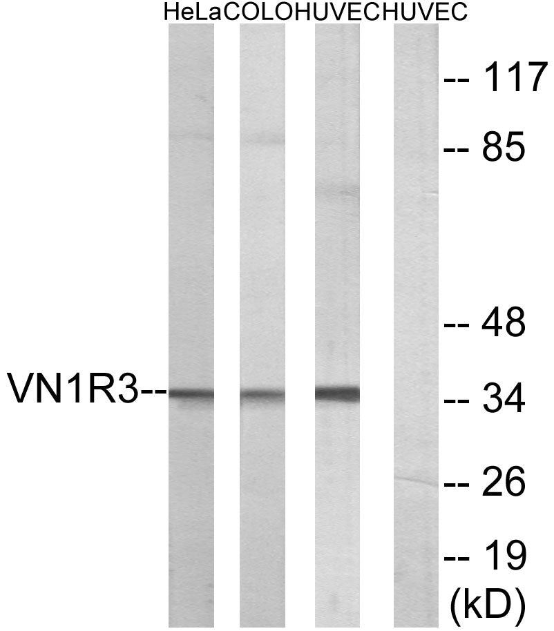 V1RL3 Rabbit Polyclonal Antibody