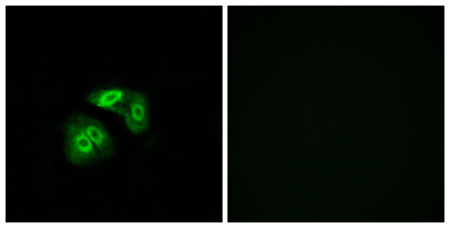 V1RL5 Rabbit Polyclonal Antibody