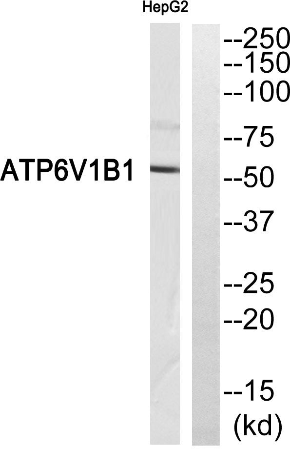 V-ATPase B1 Rabbit Polyclonal Antibody