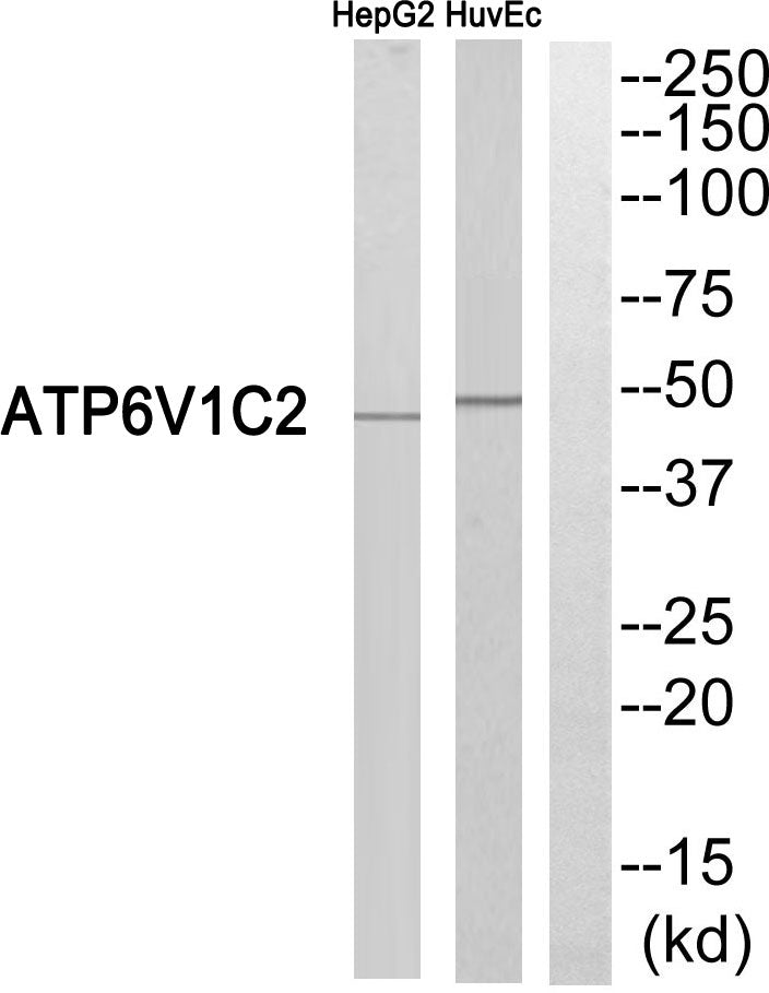 V-ATPase C2 Rabbit Polyclonal Antibody