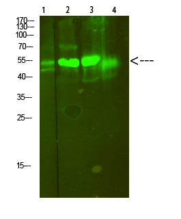 V-ATPase S1 Rabbit Polyclonal Antibody