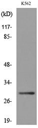 VDAC1 Rabbit Polyclonal Antibody