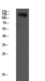 VE-Cadherin Rabbit Polyclonal Antibody
