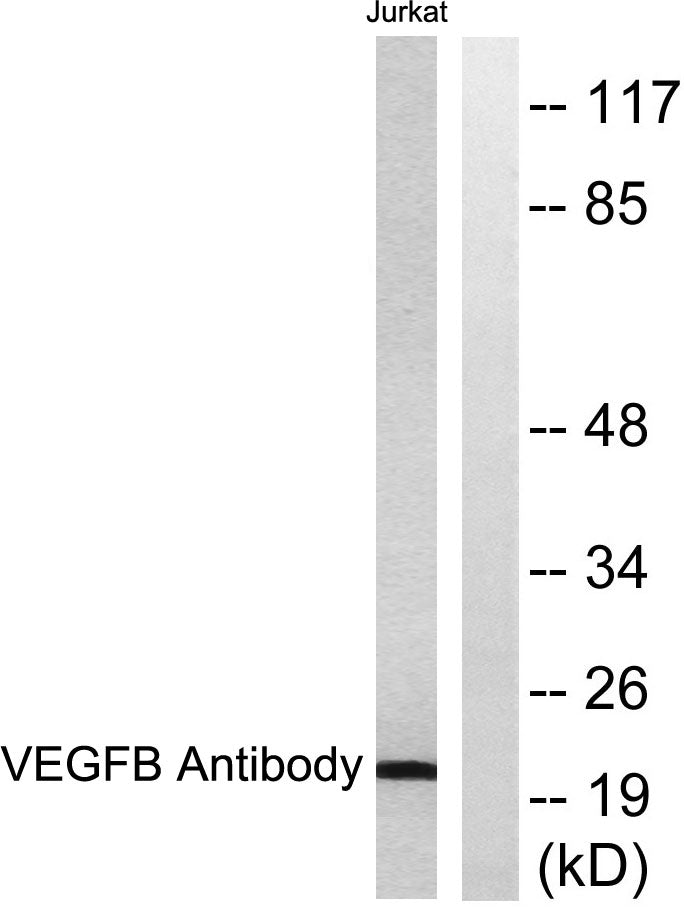 VEGF-B Rabbit Polyclonal Antibody