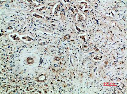VEGFR2 Rabbit Polyclonal Antibody