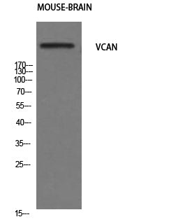 Versican Rabbit Polyclonal Antibody