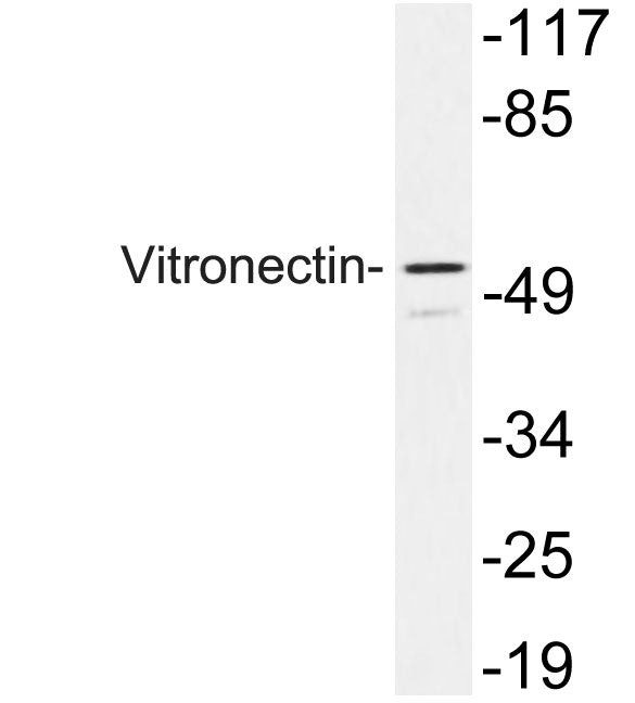 Vitronectin Rabbit Polyclonal Antibody