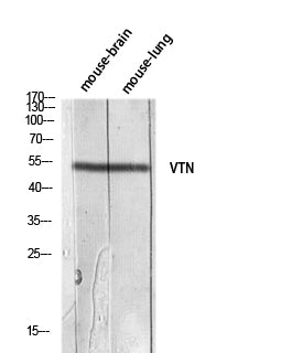 Vitronectin Rabbit Polyclonal Antibody