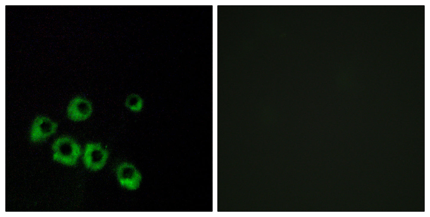 VPAC1 Rabbit Polyclonal Antibody