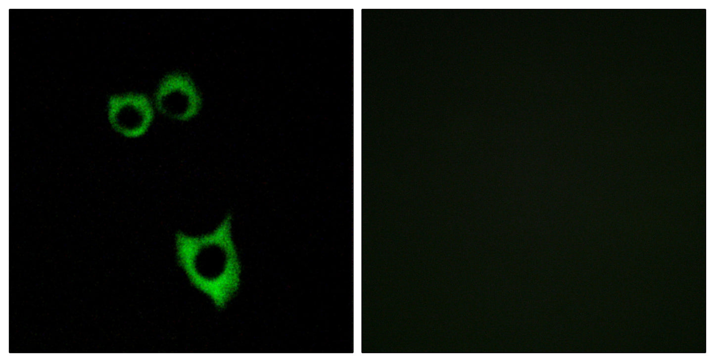 VPAC2 Rabbit Polyclonal Antibody