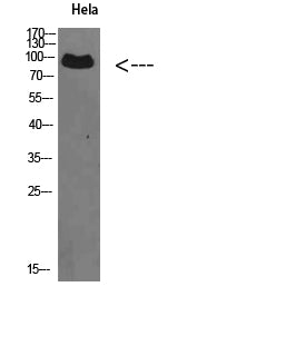 VPS35 Rabbit Polyclonal Antibody