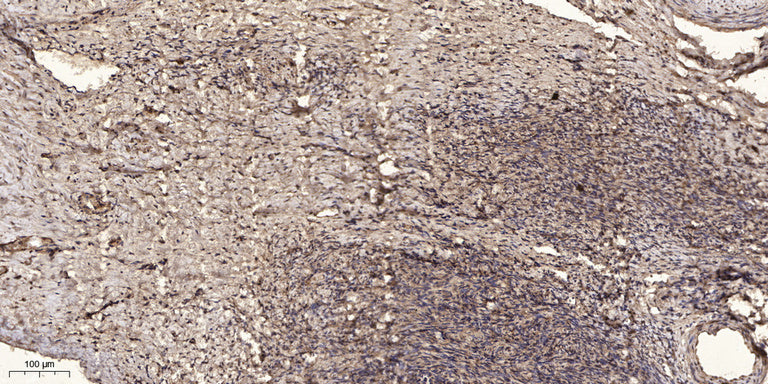 VPS54 Rabbit Polyclonal Antibody