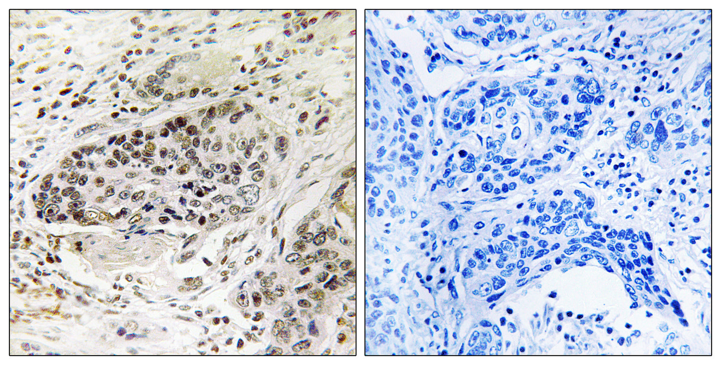 X11β Rabbit Polyclonal Antibody