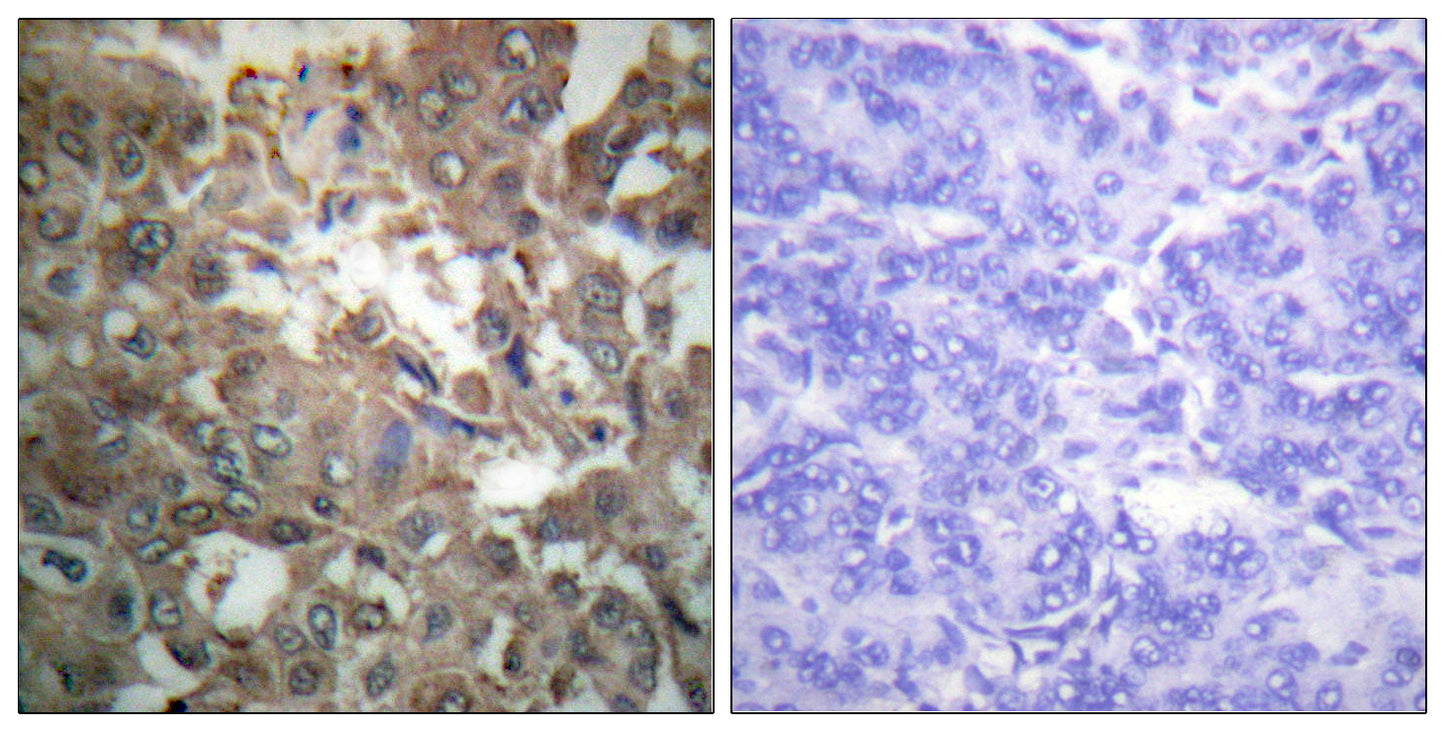 XPA Rabbit Polyclonal Antibody