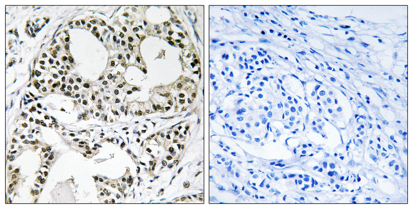 YEATS2 Rabbit Polyclonal Antibody
