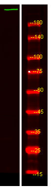 ZC3H1 Rabbit Polyclonal Antibody