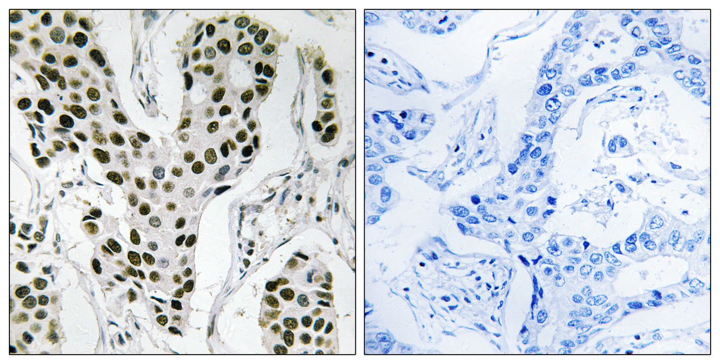 ZC3H4 Rabbit Polyclonal Antibody