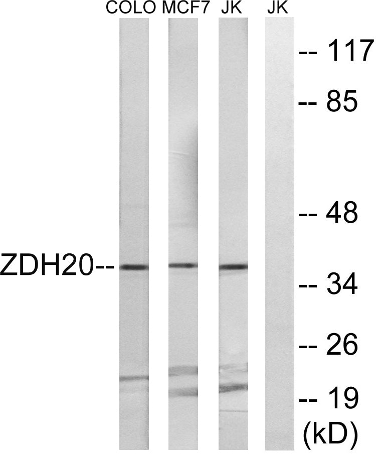 ZDHHC20 Rabbit Polyclonal Antibody