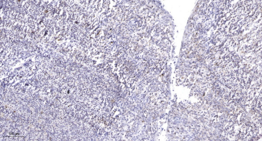 ZFHX2 Rabbit Polyclonal Antibody