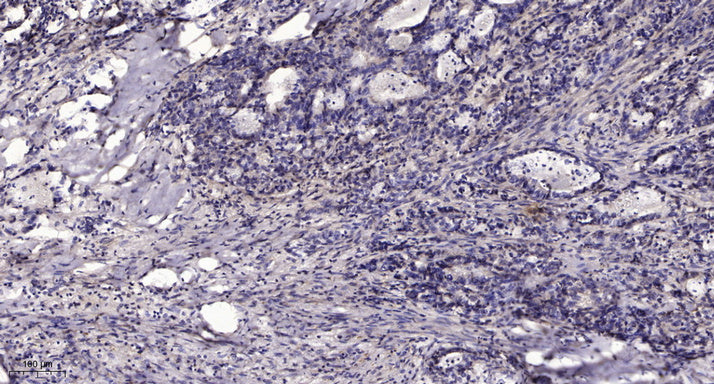 ZFY26 Rabbit Polyclonal Antibody