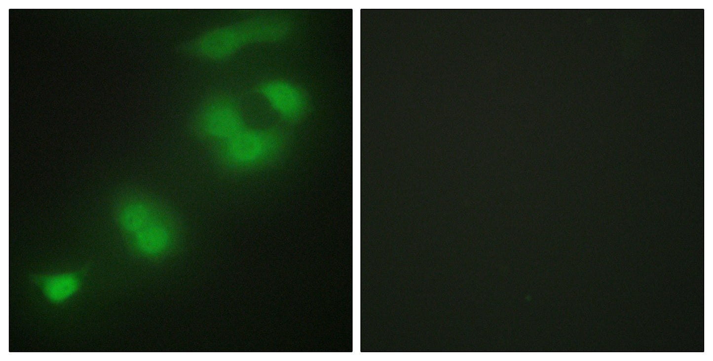 Zhangfei Rabbit Polyclonal Antibody
