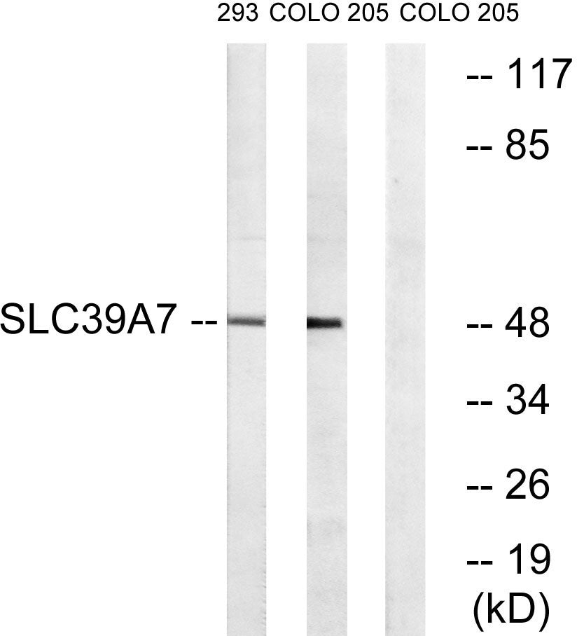 ZIP7 Rabbit Polyclonal Antibody
