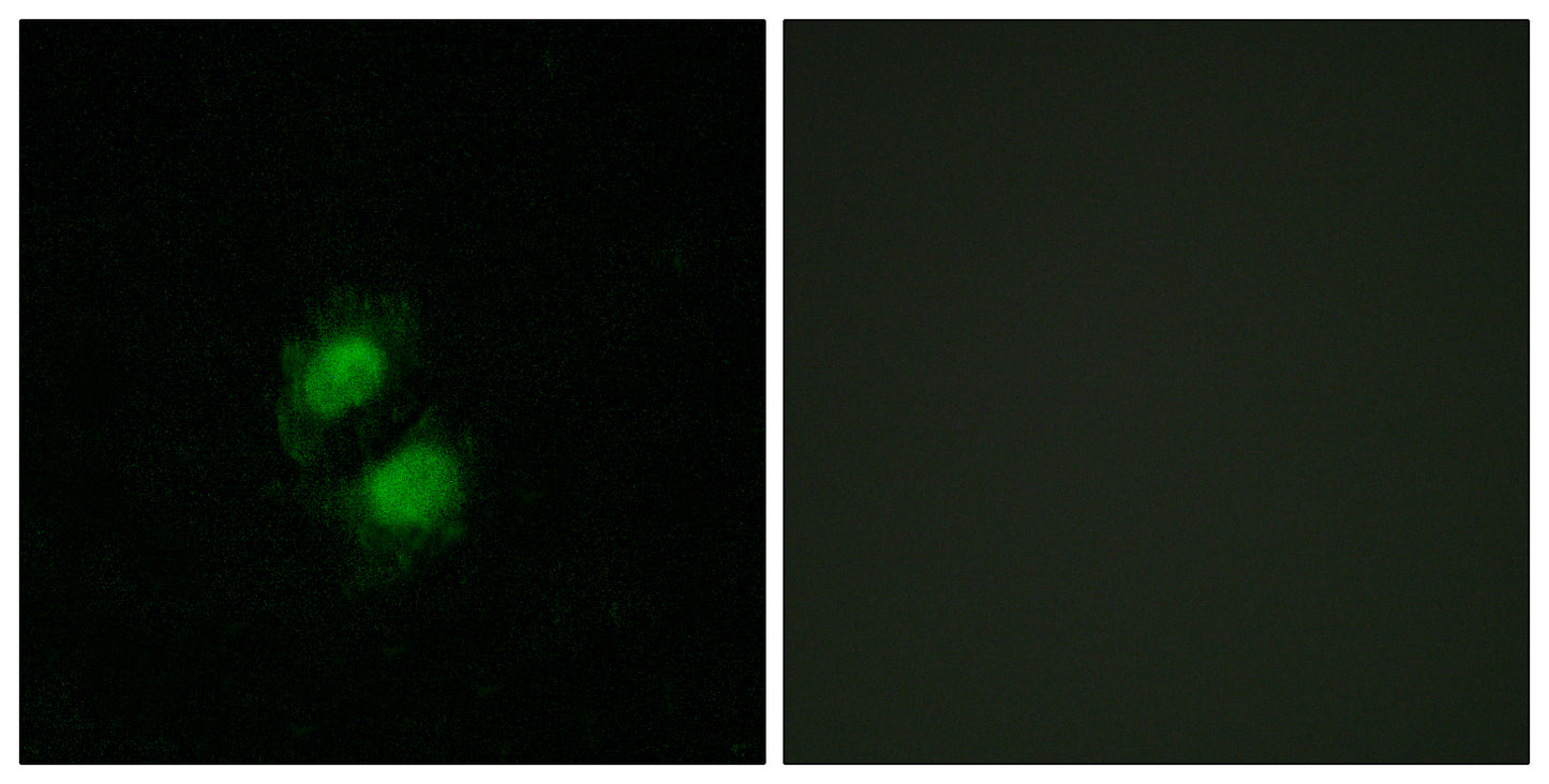 ZKSCAN5 Rabbit Polyclonal Antibody