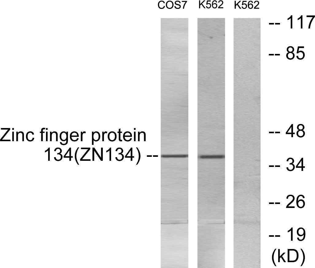 ZNF134 Rabbit Polyclonal Antibody